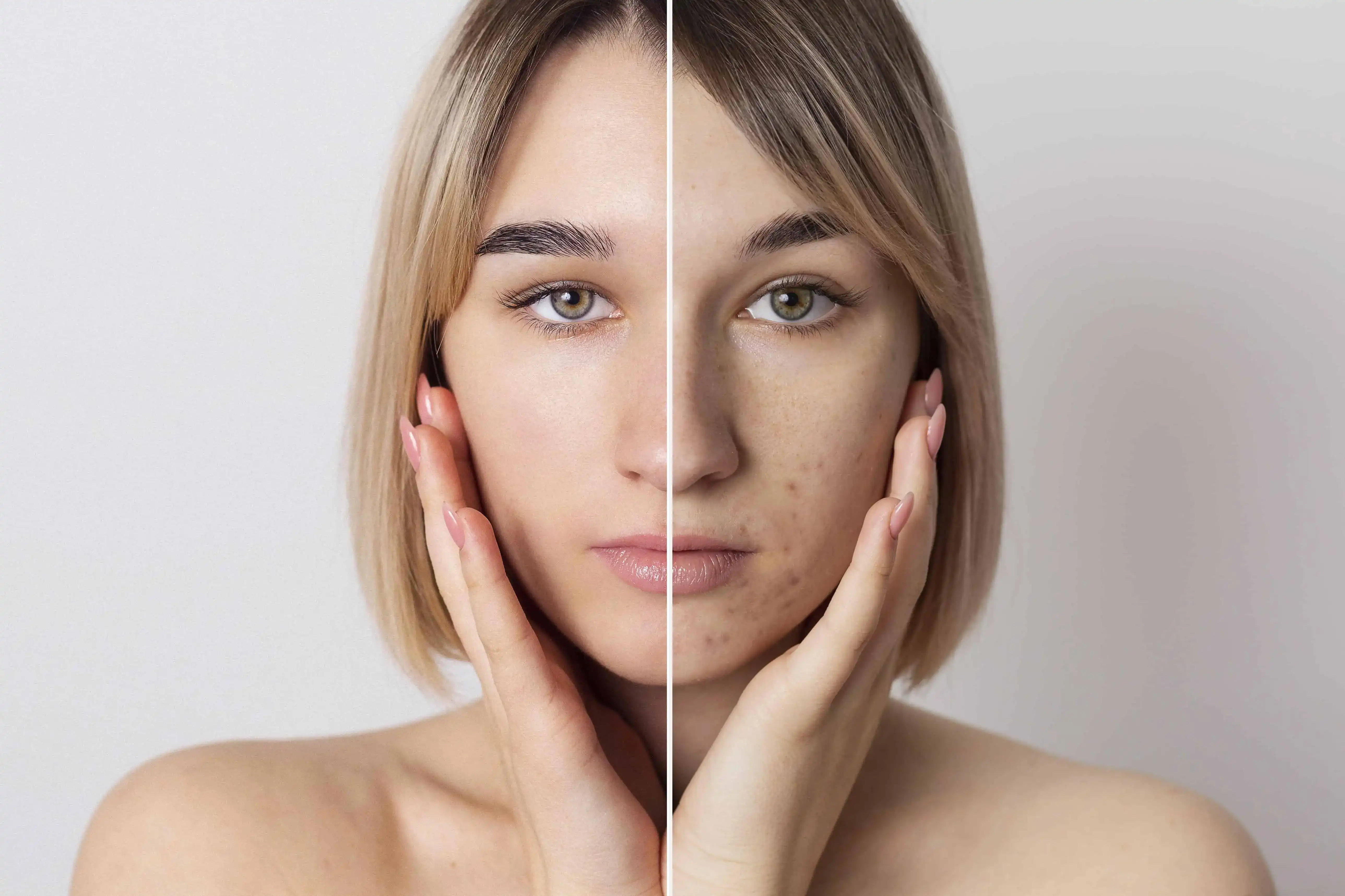 Unlocking Radiant Skin: The Most Effective Ways to Bid Adieu to Post-Acne Woes